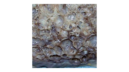 Lungenfibrosebroschüre